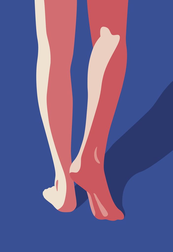 Here Comes the Rain (part 2) – limited edition print by Robert Fiszer